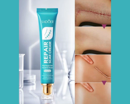 🌟CREMA SUAVIZANTE PARA MARCAS EN LA PIEL - SADOER🌟