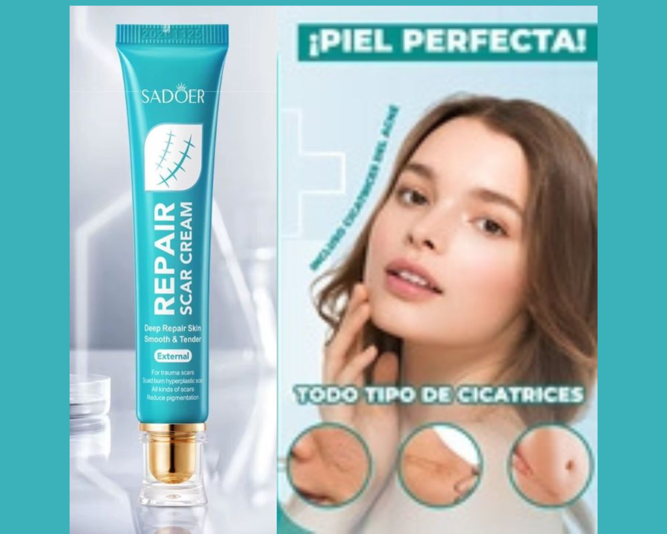 🌟CREMA SUAVIZANTE PARA MARCAS EN LA PIEL - SADOER🌟
