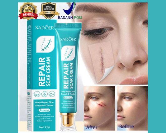 🌟CREMA SUAVIZANTE PARA MARCAS EN LA PIEL - SADOER🌟