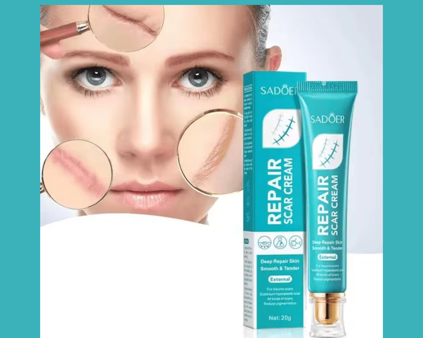 🌟CREMA SUAVIZANTE PARA MARCAS EN LA PIEL - SADOER🌟