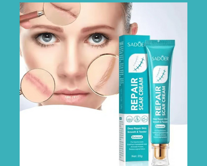 🌟CREMA SUAVIZANTE PARA MARCAS EN LA PIEL - SADOER🌟