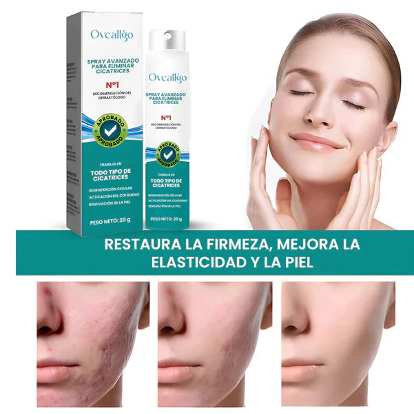 SPRAY PARA CICATRICES Y ESTRÍAS🔬🌟