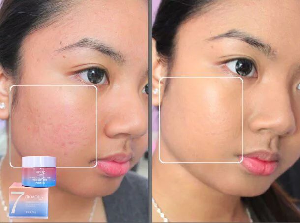 CREMA ACLARANTE 7 BENEFICIOS
