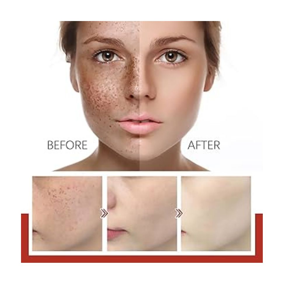 🌟ACLARA, ILUMINA Y RENUEVA: EL SERUM COREANO QUE TRANSFORMARÁ TU PIEL💧🔬