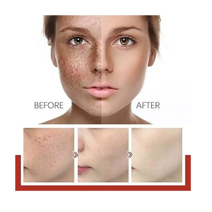 🌟ACLARA, ILUMINA Y RENUEVA: EL SERUM COREANO QUE TRANSFORMARÁ TU PIEL💧🔬