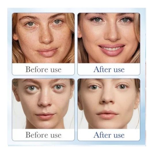 🌟ADIÓS ARRUGAS EN 3 SEMANAS🌟 - SERUM ANTI-ARRUGAS, Sin Botox, Ni Cirugías🔬💧