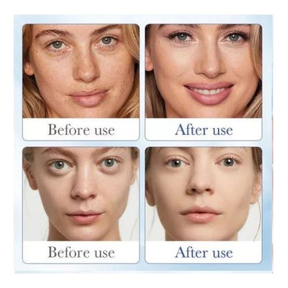 🌟ADIÓS ARRUGAS EN 3 SEMANAS🌟 - SERUM ANTI-ARRUGAS, Sin Botox, Ni Cirugías🔬💧